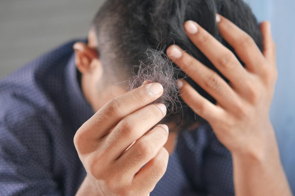cheap finasteride - male hair loss