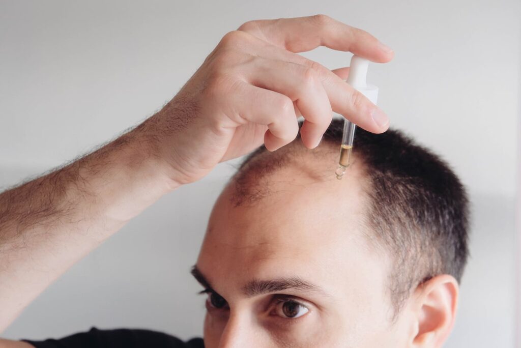 cheap finasteride - Hair loss treatment for men